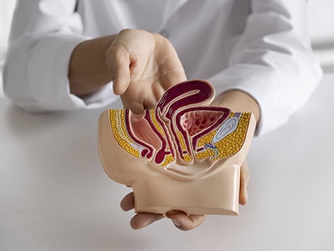 無刀口男性結紮